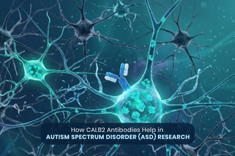 CALB2 antibodies