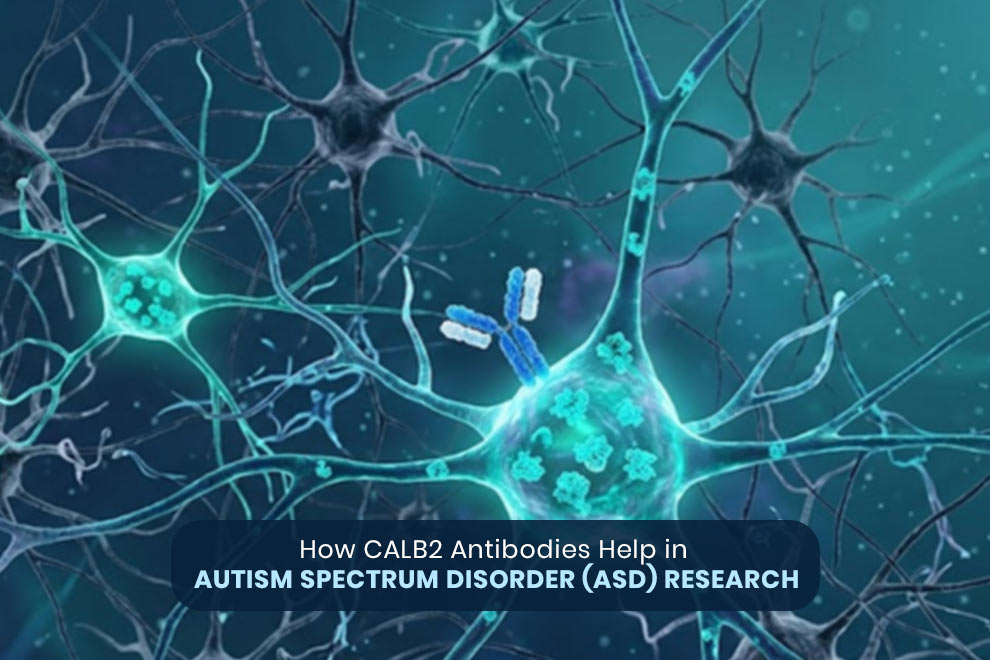 CALB2 antibodies
